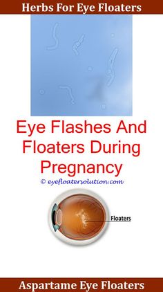 How To Reduce Floaters In Eyes Naturally Home Remes For Eye Floaters Sinus Infection And How To Reduce In