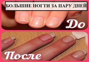 Оформление крыльца загородного дома: варианты отделки