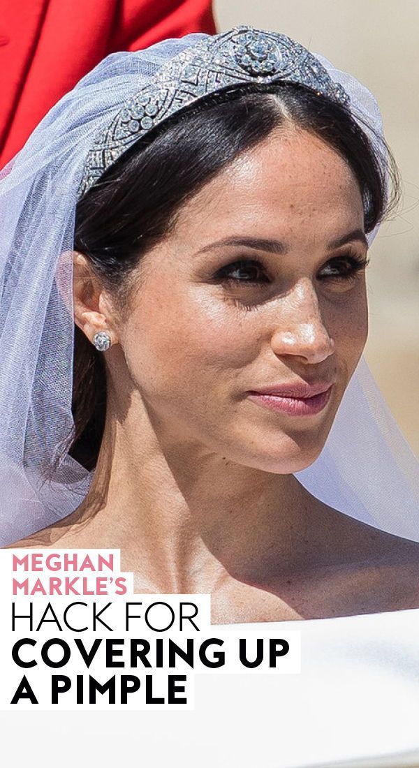 #MeghanMarkle’s hack for covering up a #pimple. #makeup #beauty #makeuptips #makeuphacks #concealertrick