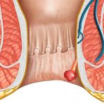 Ngứa Hậu Mon La Bệnh Gi Cach điều Trị Phong Kham Trĩ Kien Thanh Sức Khỏe Ngựa Chất Beo