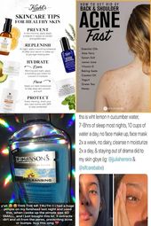 Natural Face Beauty Tips | Dermatologist Tips For Clear Skin | How To Do Skin Ca...