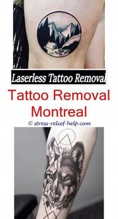 tattoo removal procedure can you use an hsa for tattoo removal - is laser tattoo..., #diytat...
