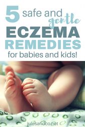Tried #all #the #expensive #creams #for #your #baby& #39;s #eczema? #Tired #of #seeing #your #child #constantly #itching #and #scratching? #I #was #at #the #end #of #my #rope #until #I #discovered #these #five #gentle #and #natural #eczema #remedies #for #kids #and #babies. #Click #through #to #help #your #child #find #eczema #relief, #too!