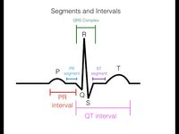 EKG/ECG Interpretation (Basic) : Easy and Simple! - YouTube