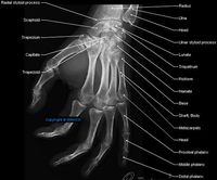 anatomy of radiograph of upper limb | ANATOMY: ANATOMY OF THE UPPER EXTREMITY IN STANDARD RADIOLOGY