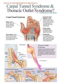 great diagram. Carpal Tunnel Syndrome Vs. Thoracic Outlet Syndrome: a pain in the hand (and arm). by sandra.terpstra.7