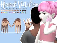 Hand Vitiligo Vitiligo is pretty common on the hands, so I felt like sims needed this too. Also, yes, this is real vitiligo, can confirm: my dad has the exact same patterns on his hands too. I wanted to make his vitiligo in the Sims 4. Information 🔹 ...
