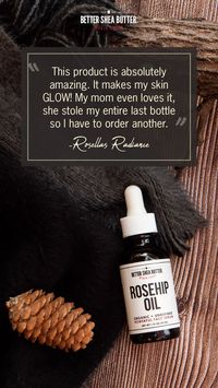 Rosehip Oil has a long list of powerful benefits. This includes its skin brightening properties that help restore the skin's natural color and tone while lightening any unwanted dark spots and blemishes.