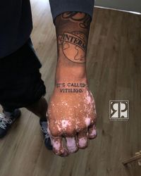 #blxckink #blxckink_usa #blxckink_usga #usatattoo #tattoousa #atlantatattoo #tattooatlanta #georgiatattoo #tattoogeorgia #vitiligotattoo #armtattoo #handtattoo