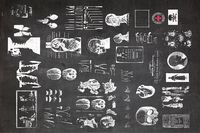 Vintage Medical Vectors #layout#Vector#quick#chalkboard