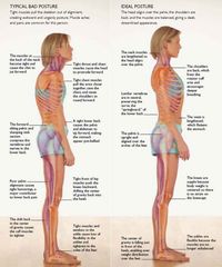 Strengthening of the core is the best way to improve your posture and correct (or prevent) back problems.