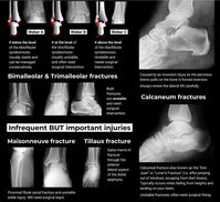 X Ray reading