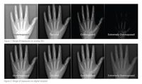 Understanding radiology exposure indicators