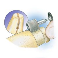 Bench Pin Tip // Grinding a groove to modify it will help brace the clamp more securely and give you a greater range of motion as you work. // #jewelrymaking