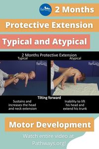 What should a 2 month old's motor development look like in the protective extension position? Watch this video for a side by side comparison of a typically and atypically developing baby. Use this to help you recognize early motor delays. #motordevelopment #motorskills #babydevelopment #baby #newbornbaby #newborndevelopment #physio #pediatrictherapy #physicaltherapy #pediatrics #earlyintervention #babyhealth #2monthsold #newborn #newparents #pediatricphysicaltherapy