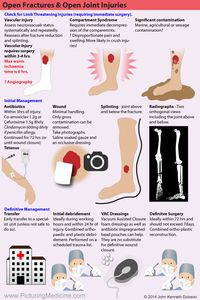 Open Lower Limb Fractures