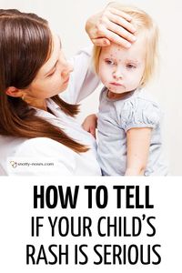 How to tell if your child's rash is serious. A great guide to childhood rashes by a pediatric doctor. #childhealth #unwellchild #unwellkid #babyrash #childhoodrashes
