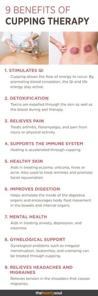What is cupping? Cupping is an ancient alternative therapy treatment in which cups are placed on the skin to create a vacuum-like suction. And here are 9 cupping therapy benefits you're missing out on! #cuppingtherapy #naturalremedies #naturaltreatments #alternativemedicine