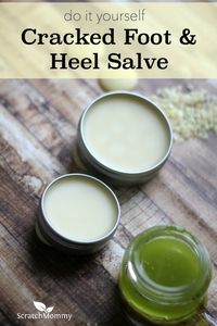 A super simple, crazy effective DIY Cracked Foot and Heel Salve Recipe which will absolutely get your feet ready for spring and summer. Get the recipe here!