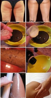 Easy Way to Get Rid of Cellulite