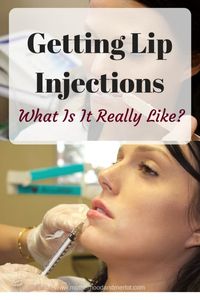 Have you ever wondered what it's really like during the process of getting lip injections? This post tells all, with before and after shots included!