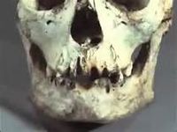 Was Father Krespi Hitler? - She was later captured by the Russian Army and made to make a drawing of Hitler’s teeth so the Russians could match the charred remains they found in the Berlin bunker with her drawing since no authentic dental records could be found.