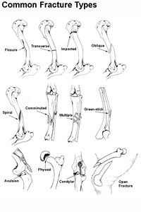 types of bone fractures and treatment | Glendale Animal Hospital - The Family Veterinarian