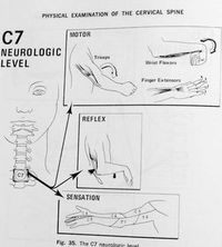 Neck, Shoulder & Arm Pain, your spine works with your brain to supply control signs and information. #chiropracticcare #C7