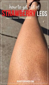 strawberry-legs