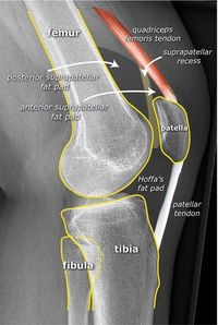Knee X-RAY