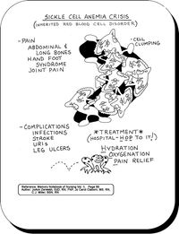 Sickle Cell Crisis