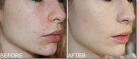 Foundation Application Guide For Beginners