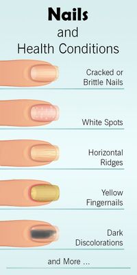 #11! 😀 nails-health-conditions