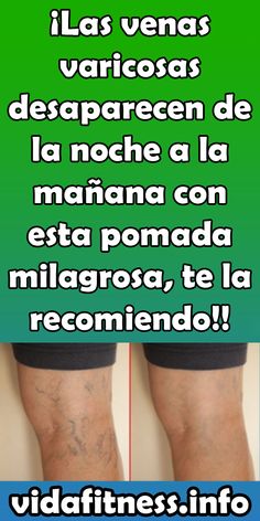 Porque tengo los dedos del pie hinchados