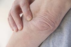 Higroma du coude etiología de la hipertensión Higroma du coude etiología de la hipertensión