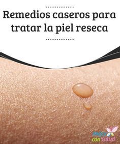 remedios caseros para piel reseca y escamosa de las piernas