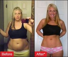 Brain Cancer Weight Loss Brain cancer weight loss