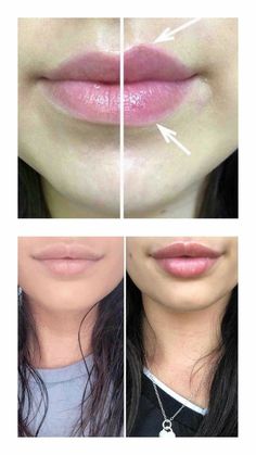 billig lip plumper billig lip plumper
