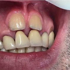 Zahnputzbecher cepillos dentales vaso plástico con camisa trazos pastel baño azul