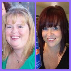 weight loss surgery sleeve reviews weight loss surgery sleeve reviews