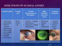 12 best specialty contact