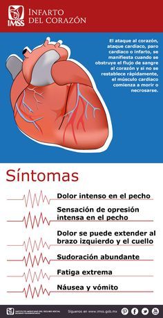 Detectar cardiaco como paro se un puede