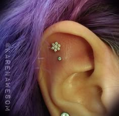love ittt. outer conch / flat (not my photo) love ittt. outer conch / flat (not my photo)
