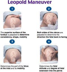 leopold maneuver