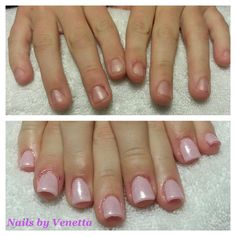 Before After Photo For A Bio Sculpture Set Of Nails Using Free Before After Pink Gel Polish On Acrylic Nails