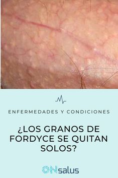 Onsalus Salud Y Bienestar Onsalus Perfil Pinterest