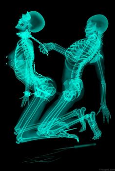 gay x ray sex Couples doing tough sex