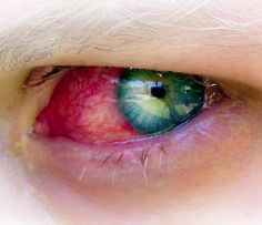 48 best pink eye