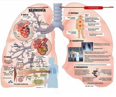 Enseñanza de enfermería de prostatitis bacteriana aguda