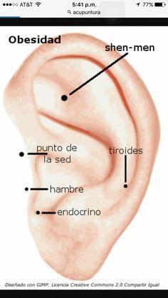 Auriculoterapia para adelgazar en mendoza